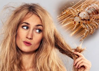 К чему снятся вши женщине: толкование сна по разным сонникам